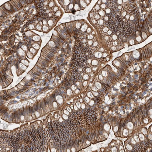 Immunohistochemical staining of human small intestine shows strong membranous and cytoplasmic positivity in glandular cells.