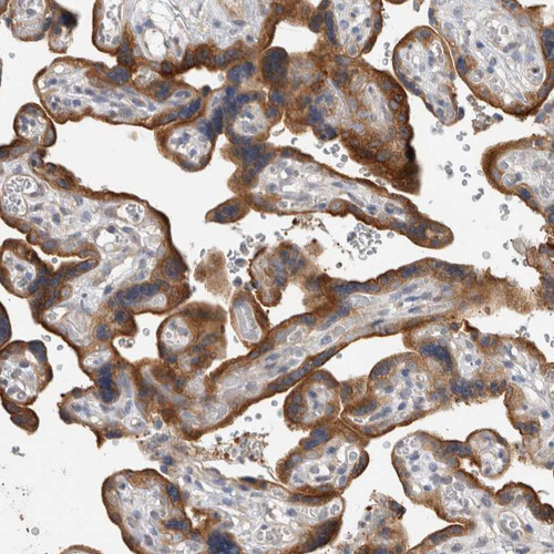 Immunohistochemical staining of human placenta shows moderate cytoplasmic positivity in trophoblastic cells.