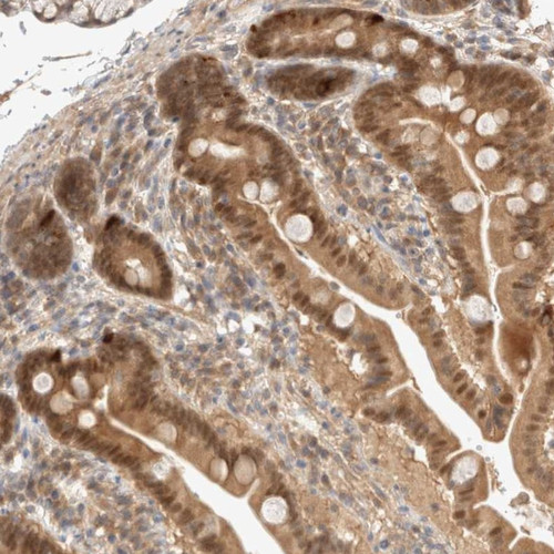 Immunohistochemical staining of human duodenum shows moderate cytoplasmic and nuclear positivity in glandular cells.