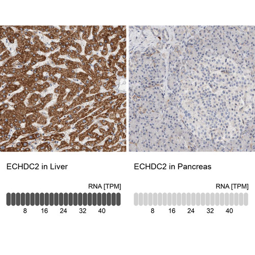 Immunohistochemistry analysis in human liver and pancreas tissues using Anti-ECHDC2 antibody. Corresponding ECHDC2 RNA-seq data are presented for the same tissues.