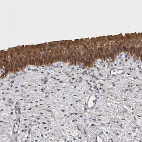 Immunohistochemical staining of human urinary bladder shows distinct cytoplasmic positivity in urothelial cells.