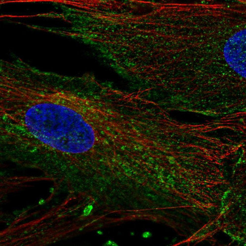 Immunofluorescent staining of human cell line BJ shows localization to plasma membrane & vesicles.