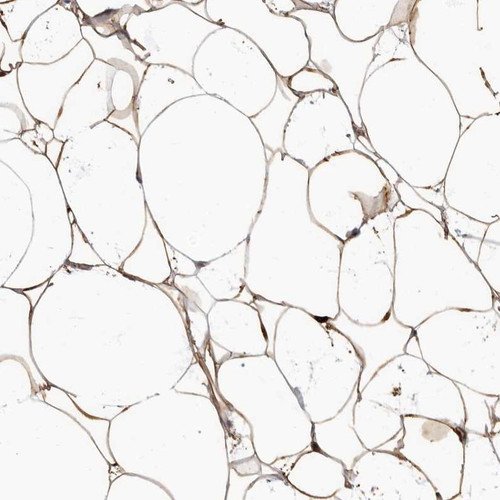 Immunohistochemical staining of human soft tissue shows cytoplasmic positivity in adipocytes.