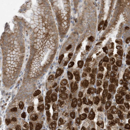 Immunohistochemical staining of human stomach shows strong cytoplasmic positivity in parietal cells.