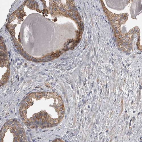 Immunohistochemical staining of human prostate shows moderate membranous positivity in glandular cells.