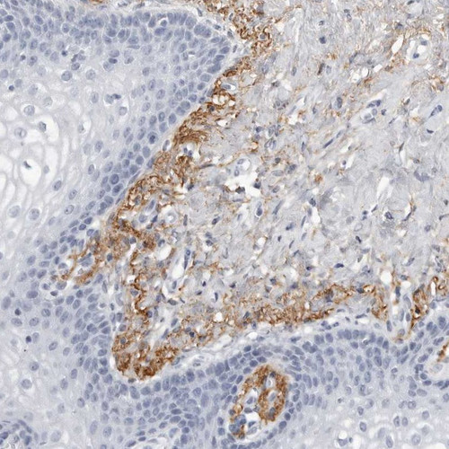 Immunohistochemical staining of human vagina shows distinct positivity in extracellular matrix.