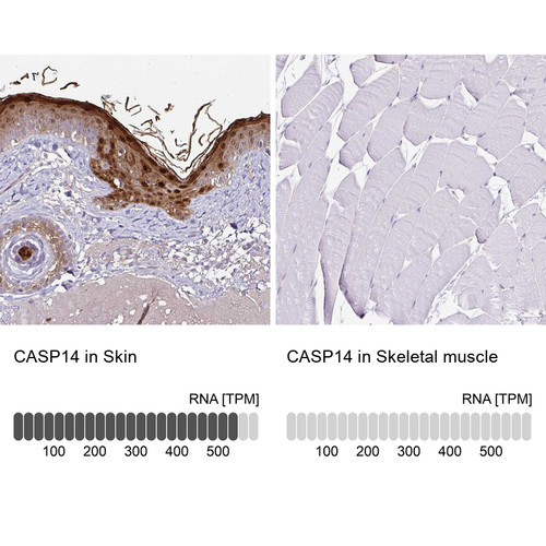 Immunohistochemistry analysis in human skin and skeletal muscle tissues using HPA027062 antibody. Corresponding CASP14 RNA-seq data are presented for the same tissues.