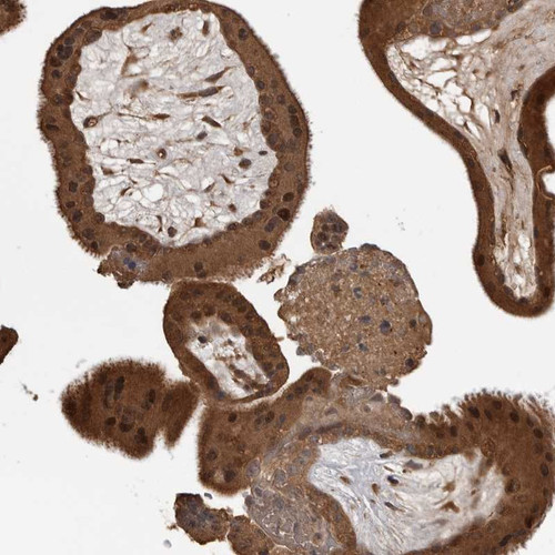 Immunohistochemical staining of human placenta shows strong cytoplasmic and nuclear positivity in trophoblastic cells.