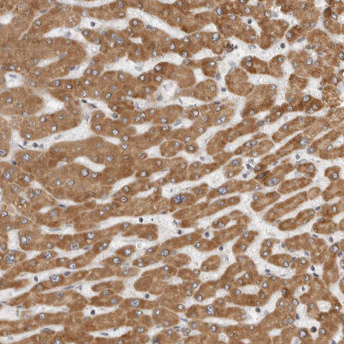 Immunohistochemical staining of human liver shows moderate to strong granular cytoplasmic positivity in hepatocytes.