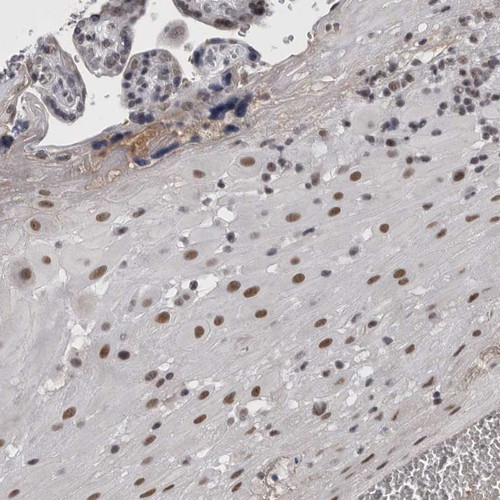 Immunohistochemical staining of human placenta shows moderate nuclear positivity in decidual cells.