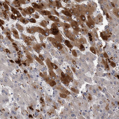 Immunohistochemical staining of human liver shows moderate to strong cytoplasmic positivity in hepatocytes.
