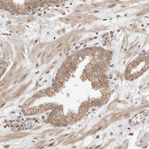 Immunohistochemical staining of human prostate shows moderate cytoplasmic positivity in glandular cells.