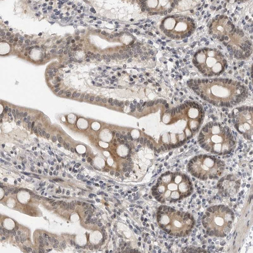 Immunohistochemical staining of human duodenum shows moderate cytoplasmic and nuclear positivity in glandular cells.