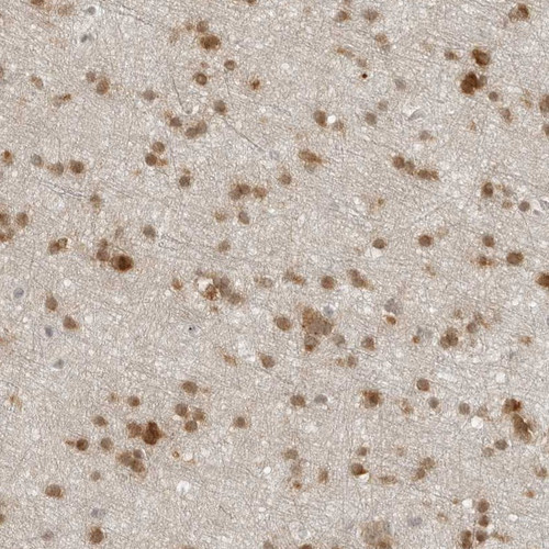 Immunohistochemical staining of human cerebral cortex shows moderate nuclear and cytoplasmic positivity in glial cells.