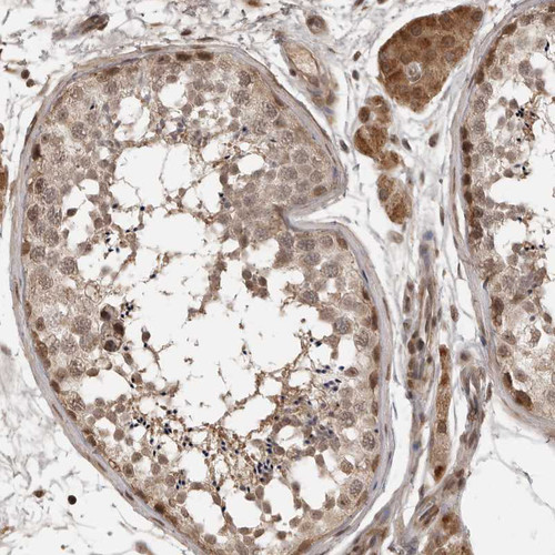 Immunohistochemical staining of human testis shows moderate nuclear and cytoplasmic positivity in cells in seminiferous ducts and Leydig cells.