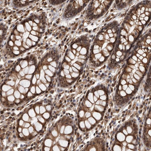 Immunohistochemical staining of human rectum shows strong cytoplasmic positivity in glandular cells.