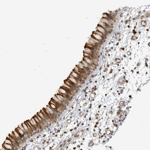 Immunohistochemical staining of human nasopharynx shows strong cytoplasmic and membranous positivity in respiratory epithelial cells.