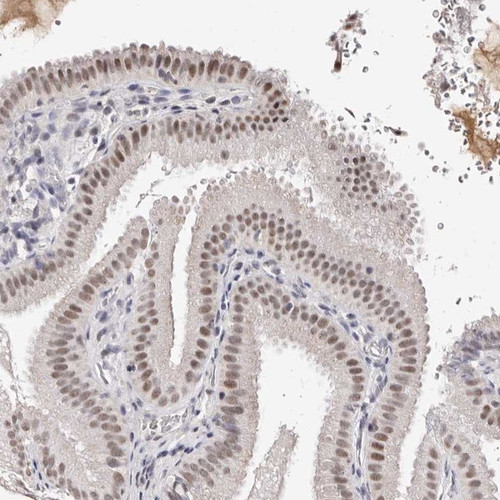 Immunohistochemical staining of human gallbladder shows nuclear positivity in glandular cells.