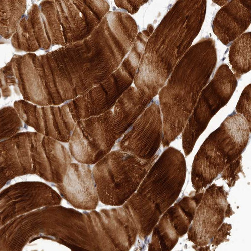 Immunohistochemical staining of human skeletal muscle shows strong cytoplasmic positivity in myocytes.