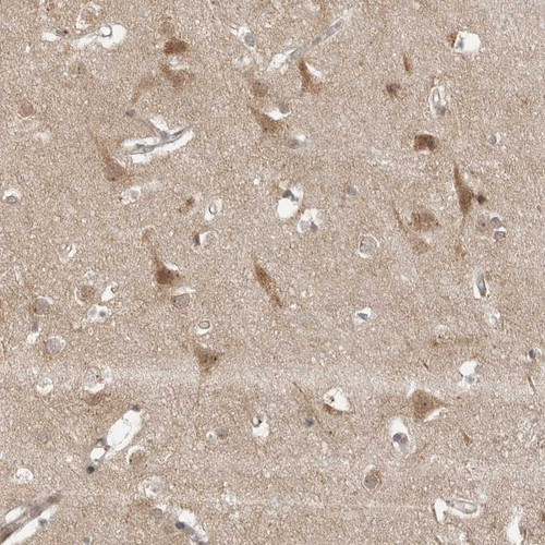 Immunohistochemical staining of human cerebral cortex shows moderate cytoplasmic positivity in neurons.
