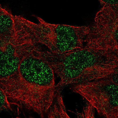 Immunofluorescent staining of human cell line SK-MEL-30 shows localization to nucleoplasm.