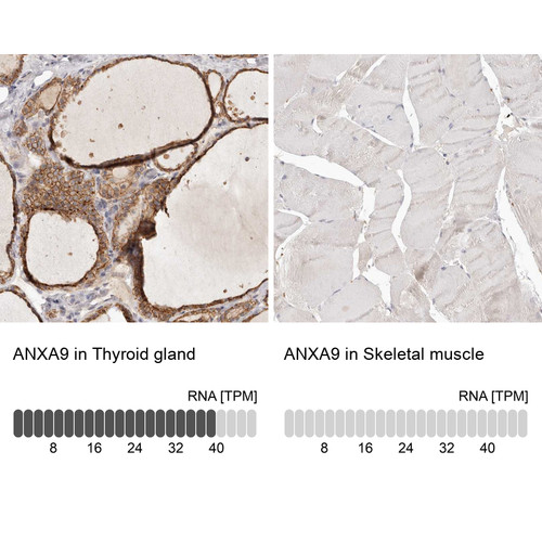Immunohistochemistry analysis in human thyroid gland and skeletal muscle tissues using Anti-ANXA9 antibody. Corresponding ANXA9 RNA-seq data are presented for the same tissues.