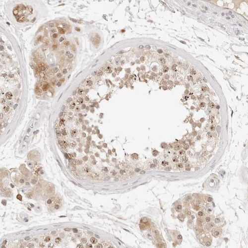 Immunohistochemical staining of human testis shows moderate nuclear positivity in cells in seminiferous ducts along with additional cytoplasmic in Leydig cells.