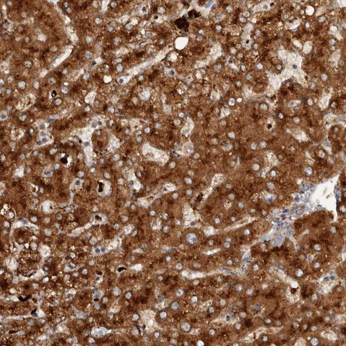 Immunohistochemical staining of human liver shows strong cytoplasmic positivity in hepatocytes.