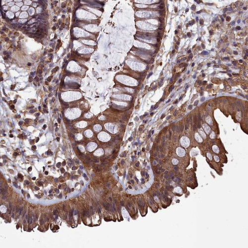 Immunohistochemical staining of human colon shows moderate cytoplasmic and membranous positivity in glandular cells.