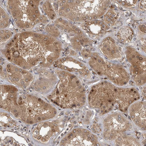Immunohistochemical staining of human kidney shows moderate nuclear positivity in subset of cells in tubules.