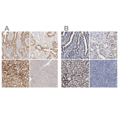 Immunohistochemical staining of human gastrointestinal, kidney, liver and pancreas using Anti-ACOX1 antibody HPA028759 (A) shows similar protein distribution across tissues to independent antibody HPA021195 (B).