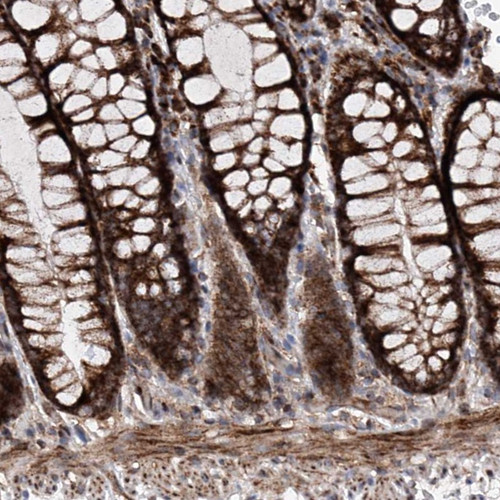 Immunohistochemical staining of human colon shows strong cytoplasmic positivity in glandular cells.