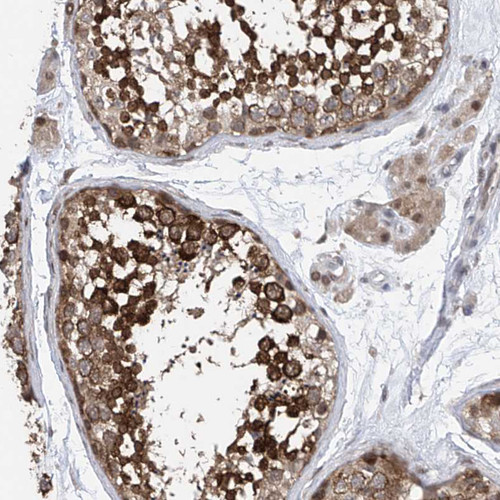 Immunohistochemical staining of human testis shows strong cytoplasmic positivity in cells in seminiferous ducts.