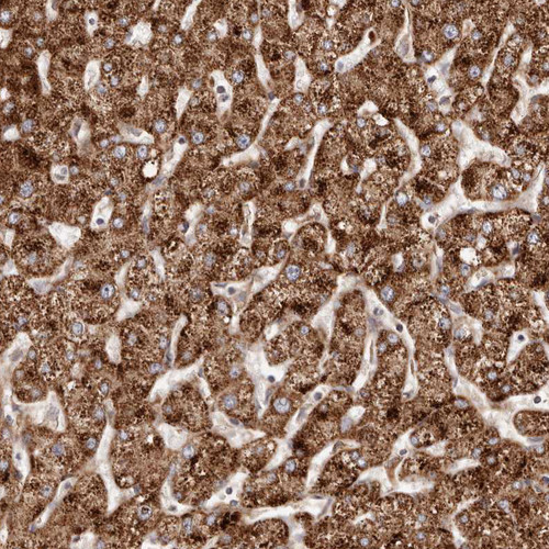 Immunohistochemical staining of human Liver shows strong granular cytoplasmic positivity in hepatocytes.