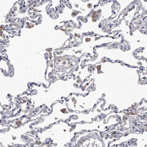 Immunohistochemical staining of human lung shows moderate cytoplasmic positivity in macrophages.