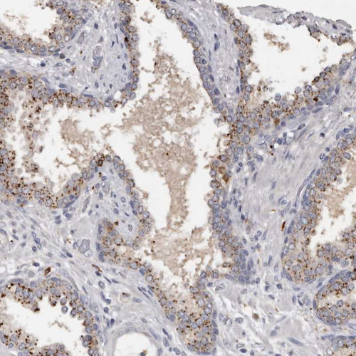 Immunohistochemical staining of human prostate shows moderate granular positivity in glandular cells.
