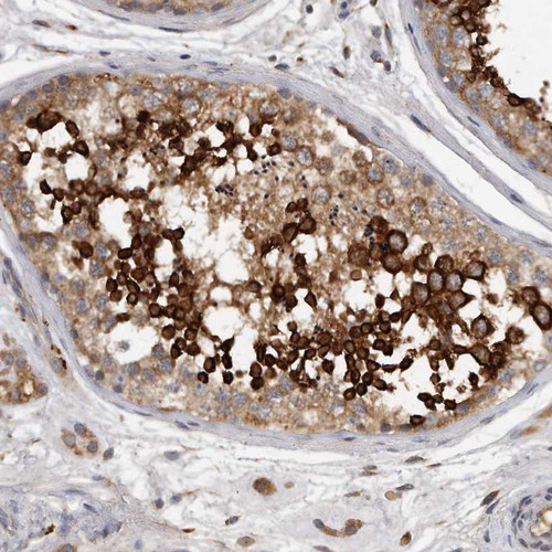 Immunohistochemical staining of human testis shows strong cytoplasmic positivity in subset of cells in seminiferus ducts.