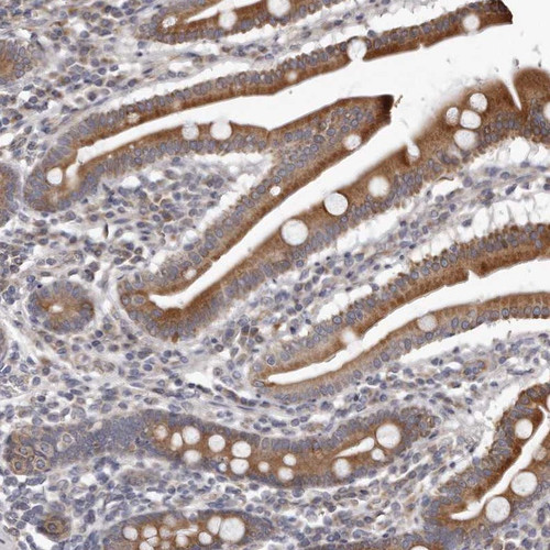 Immunohistochemical staining of human duodenum shows moderate cytoplasmic positivity in glandular cells.