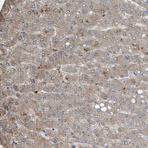 Immunohistochemical staining of human Liver shows moderate cytoplasmic positivity in hepatocytes.