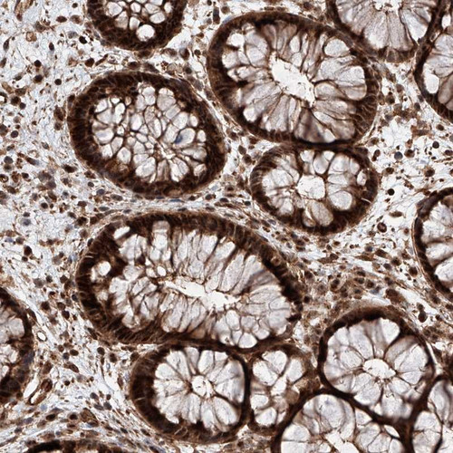 Immunohistochemical staining of human rectum shows strong cytoplasmic and nuclear positivity in glandular cells.