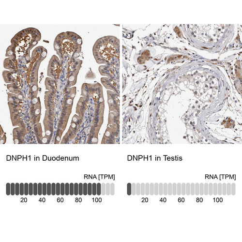 Immunohistochemistry analysis in human duodenum and testis tissues using HPA029675 antibody. Corresponding DNPH1 RNA-seq data are presented for the same tissues.