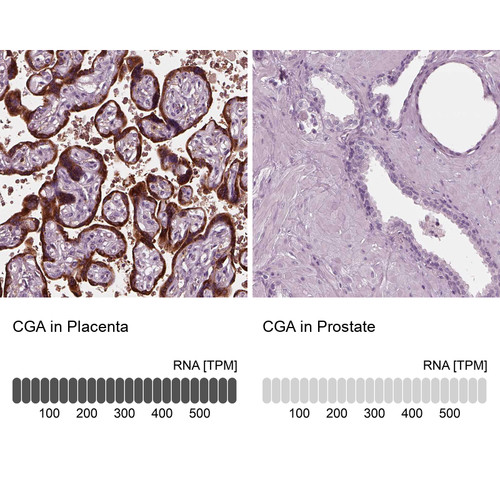 Immunohistochemistry analysis in human placenta and prostate tissues using HPA029698 antibody. Corresponding CGA RNA-seq data are presented for the same tissues.