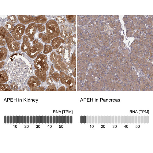 Immunohistochemistry analysis in human kidney and pancreas tissues using Anti-APEH antibody. Corresponding APEH RNA-seq data are presented for the same tissues.
