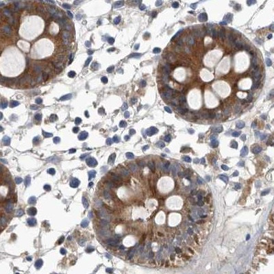 Immunohistochemical staining of human colon using Anti-APEH antibody HPA029703.