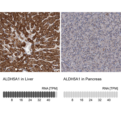 Immunohistochemistry analysis in human liver and pancreas tissues using Anti-ALDH5A1 antibody. Corresponding ALDH5A1 RNA-seq data are presented for the same tissues.