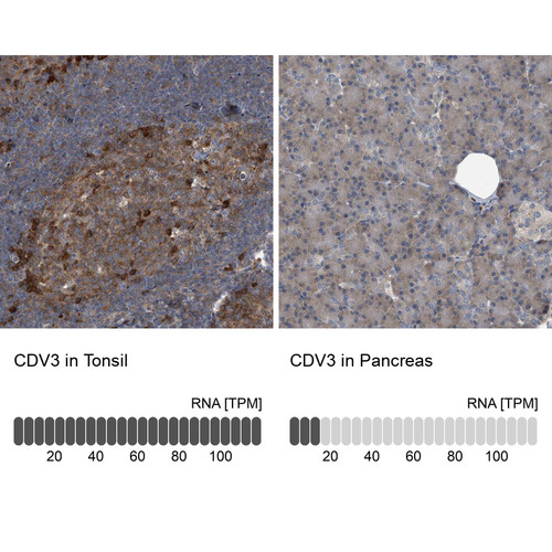 Immunohistochemistry analysis in human tonsil and pancreas tissues using Anti-CDV3 antibody. Corresponding CDV3 RNA-seq data are presented for the same tissues.