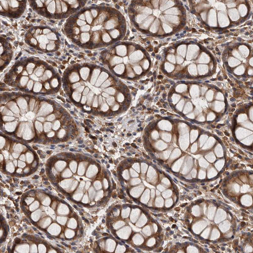 Immunohistochemical staining of human gastrointestinal shows strong cytoplasmic positivity in glandular cells.