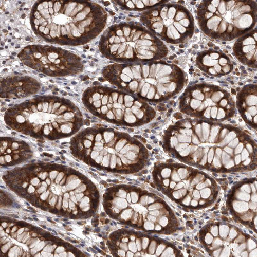 Immunohistochemical staining of human gastrointestinal shows strong cytoplasmic positivity in glandular cells.