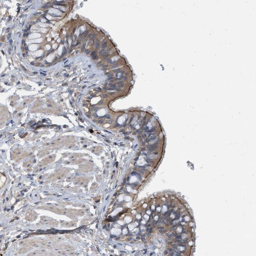 Immunohistochemical staining of human bronchus shows moderate cytoplasmic and membranous positivity in respiratory epithelial cells.