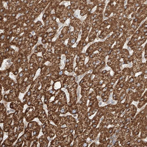Immunohistochemical staining of human liver shows strong cytoplasmic positivity in hepatocytes.